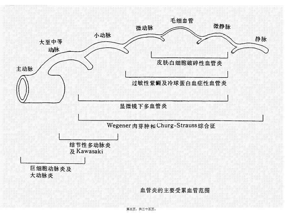 ANCA相关性血管炎的诊治进展.pptx_第3页