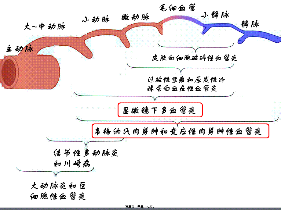 ANCA相关性小血管炎-.pptx_第3页