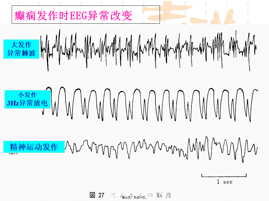 9-抗癫痫药和抗惊厥药本-09.pptx_第3页