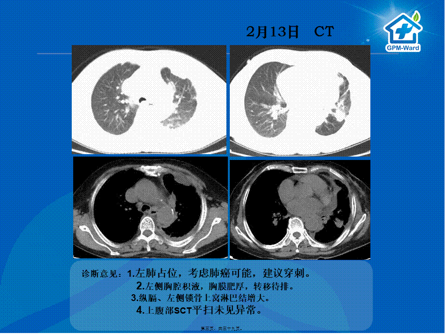 5-16癌痛病例分享(郑大一附院王峰).pptx_第3页