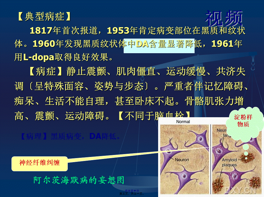 cq抗帕金森病解读.pptx_第3页