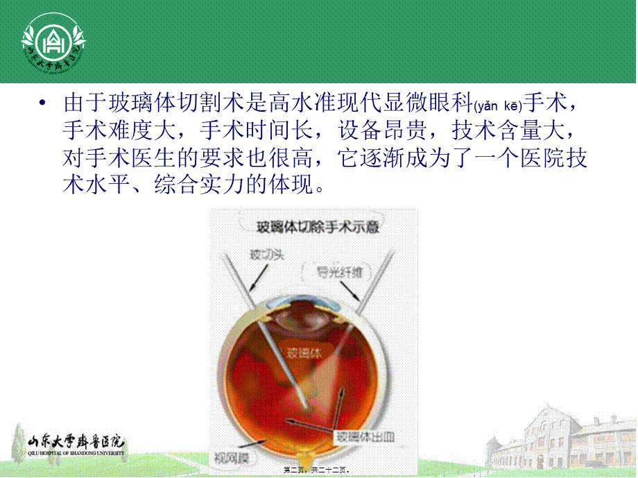 2022年医学专题—玻璃体切割术适应征.pptx_第2页