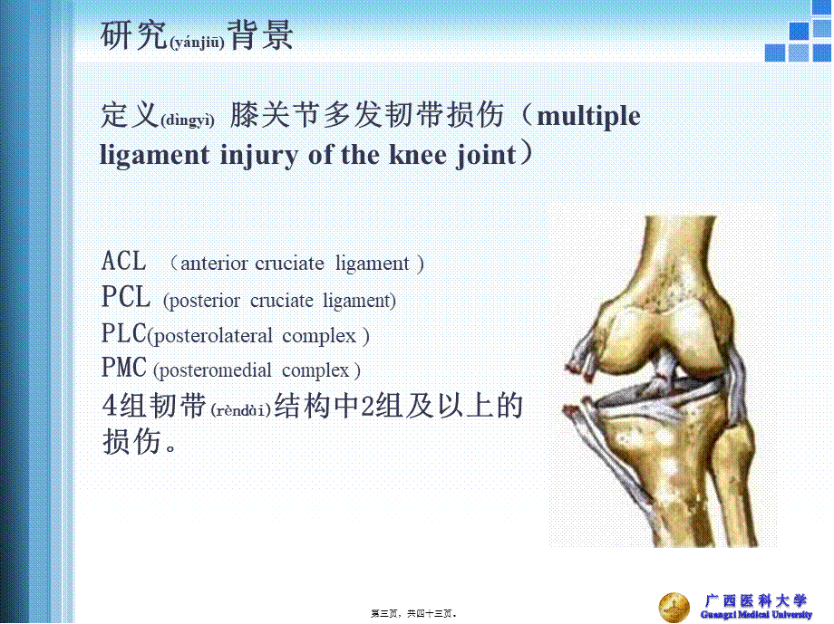 2022年医学专题—关节镜膝关节多发韧带损伤的修复.pptx_第3页