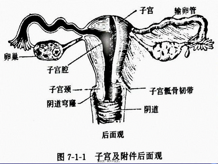 2022年医学专题—妇科超声检查.ppt_第3页