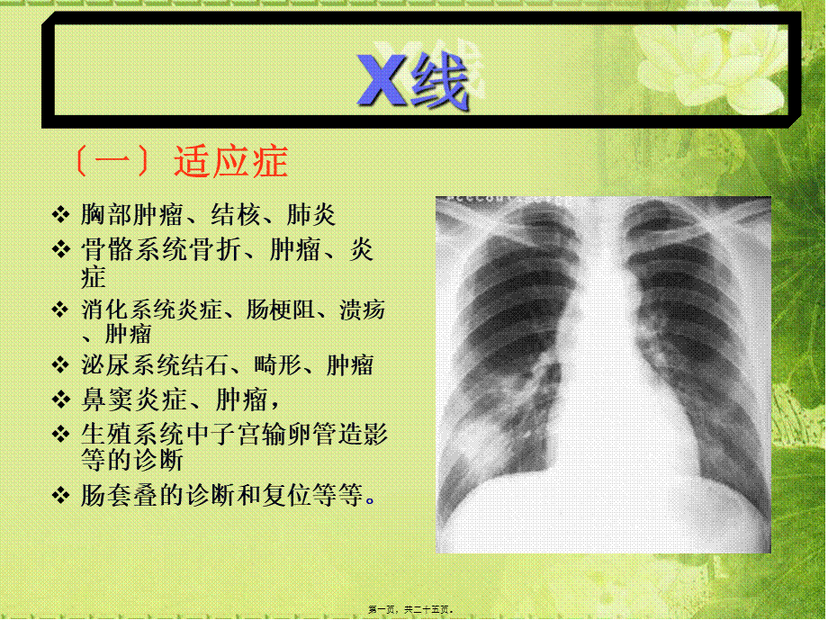 X线CT-DSA--MRI-PETCT-超声的适应症禁忌优势及缺点.pptx_第1页