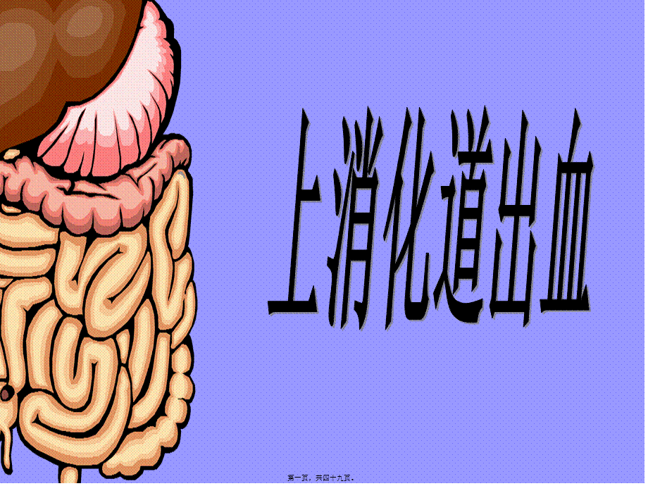 上消化道大量出血.pptx_第1页