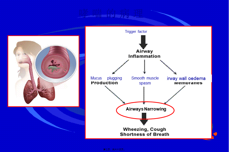 2022年医学专题—哮喘的炎症指标最新进展-节选.ppt_第2页