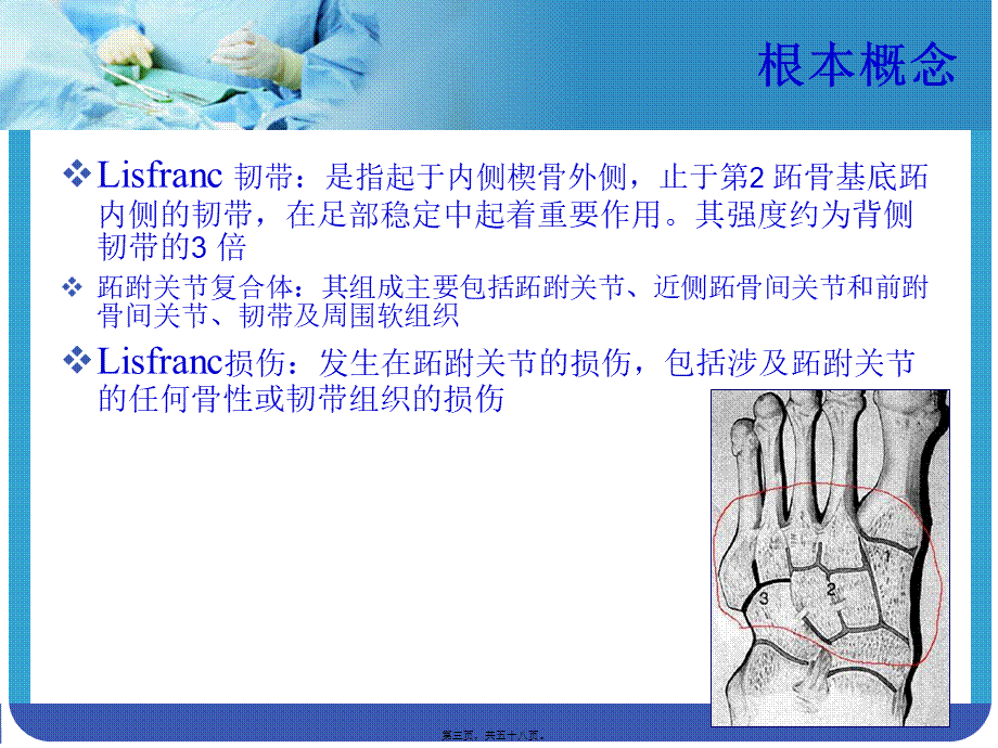 Lisfranc-损伤.pptx_第3页