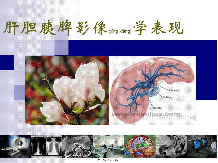 2022年医学专题—肝胆胰脾影像表现分析.ppt_第1页