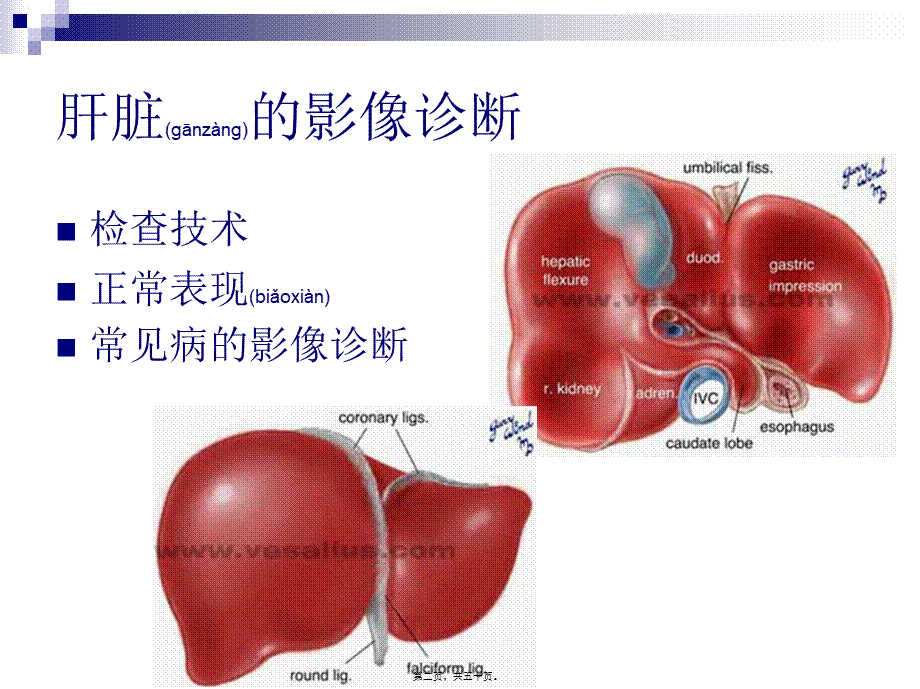 2022年医学专题—肝胆胰脾影像表现分析.ppt_第2页