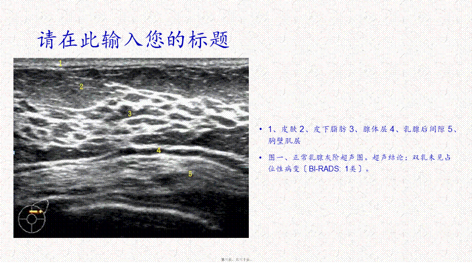 乳腺共识.ppt_第3页