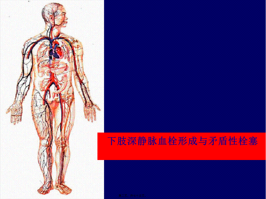 下肢静脉血栓详解.pptx_第2页