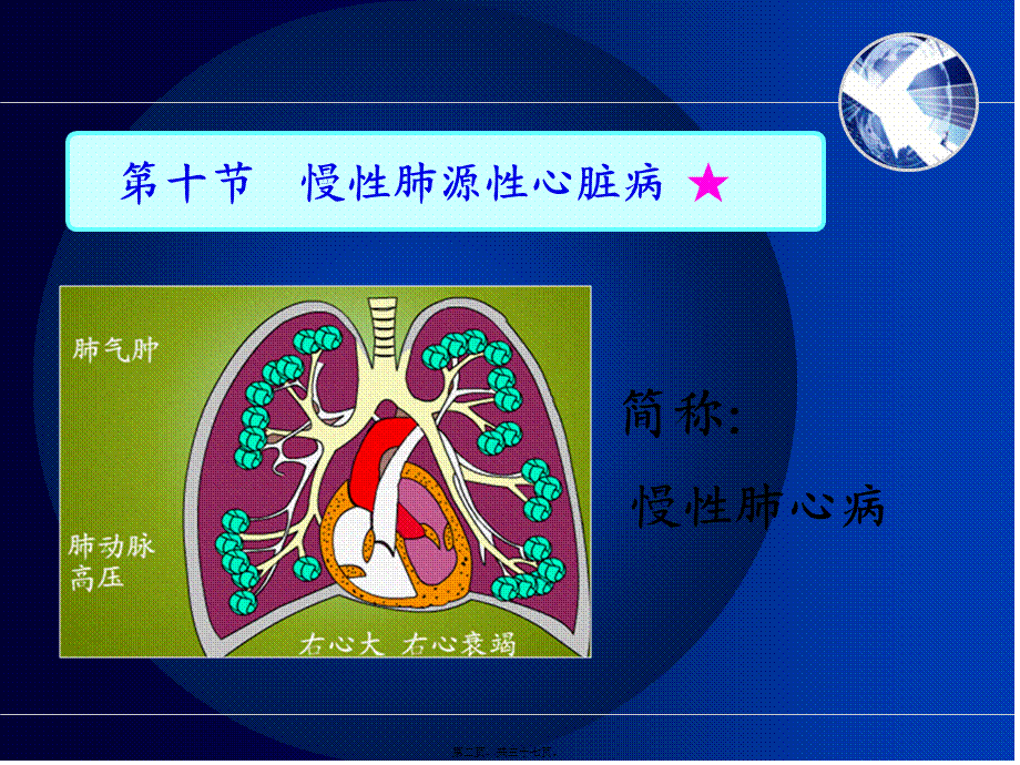 5慢性肺源性心脏病.pptx_第2页