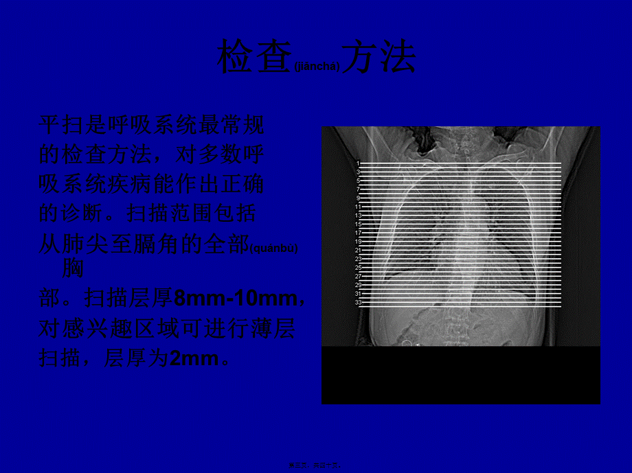 2022年医学专题—胸部CT基础知识.ppt_第3页