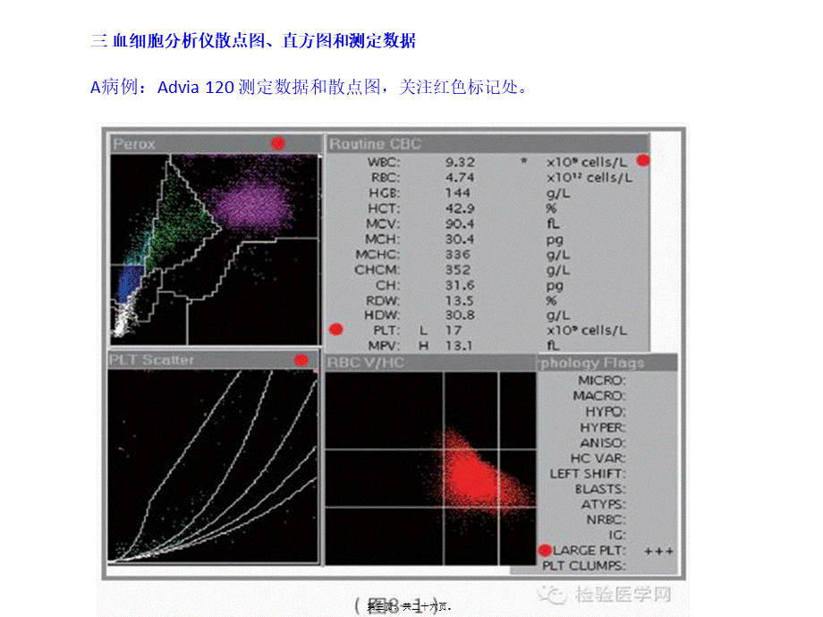 EDTA依赖性假性血小板减少.ppt_第3页