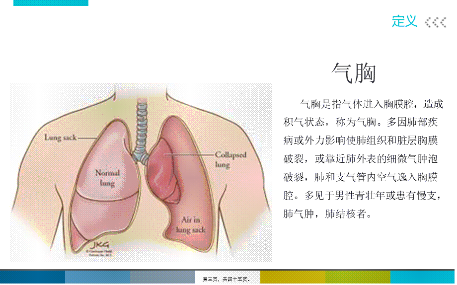 Ⅱ型呼衰合并气胸个案2.pptx_第3页