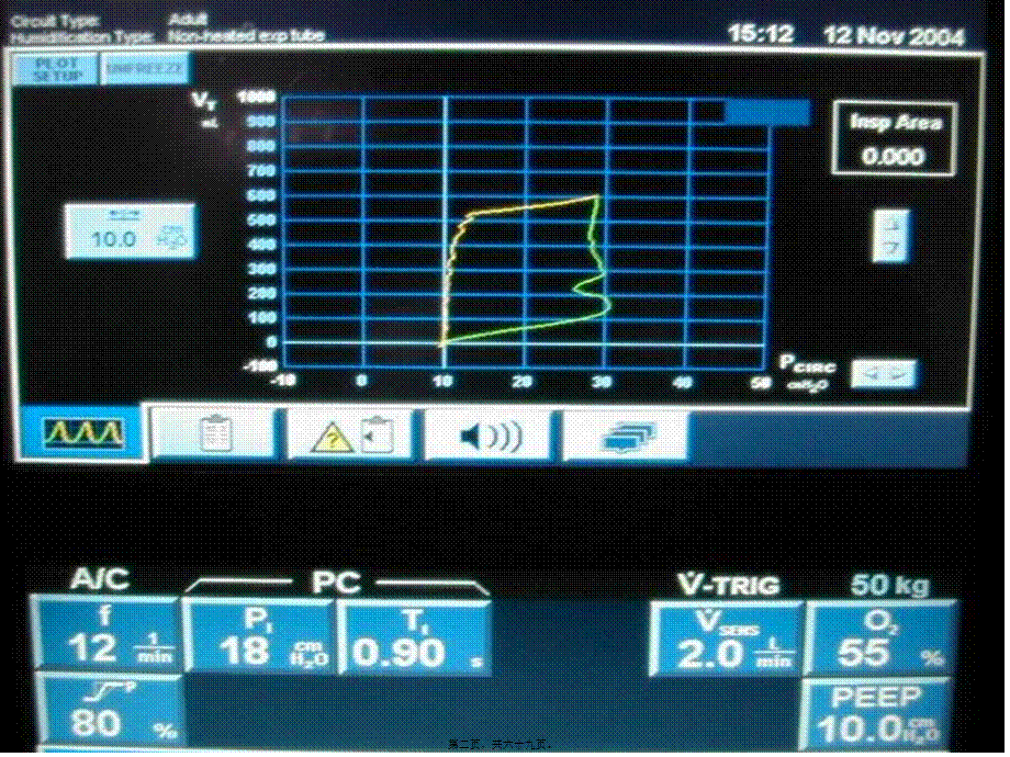 呼吸机基本波形详解.pptx_第2页