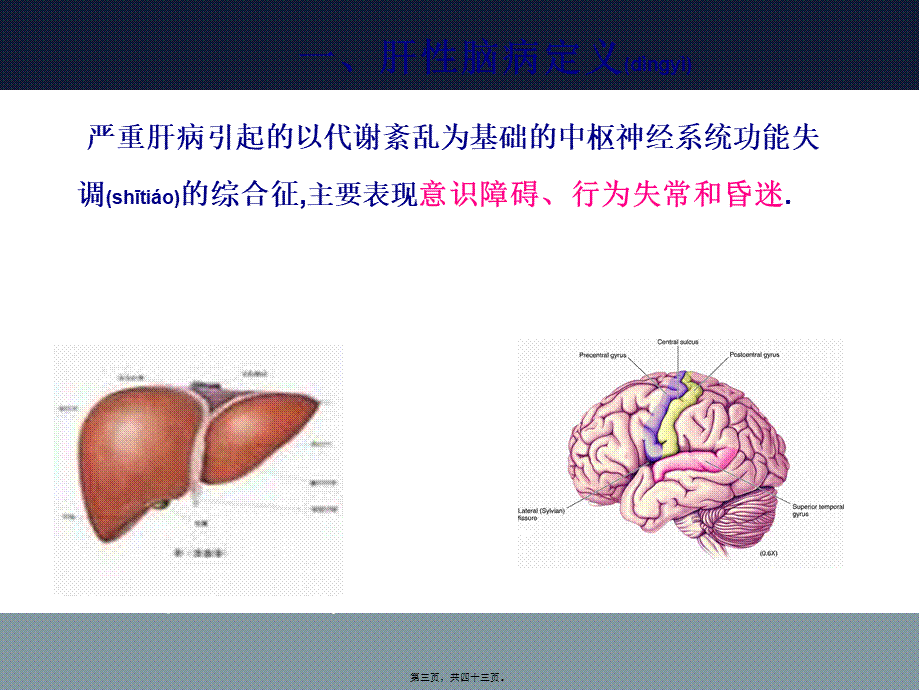 2022年医学专题—肝--性--脑--病.ppt_第3页