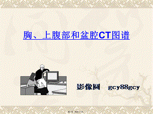 上腹和盆腔CT详细实用图解.ppt.pptx