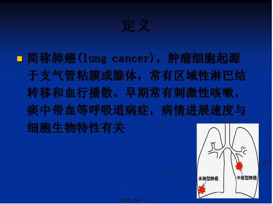 原发性支气管肺癌概述.pptx_第3页