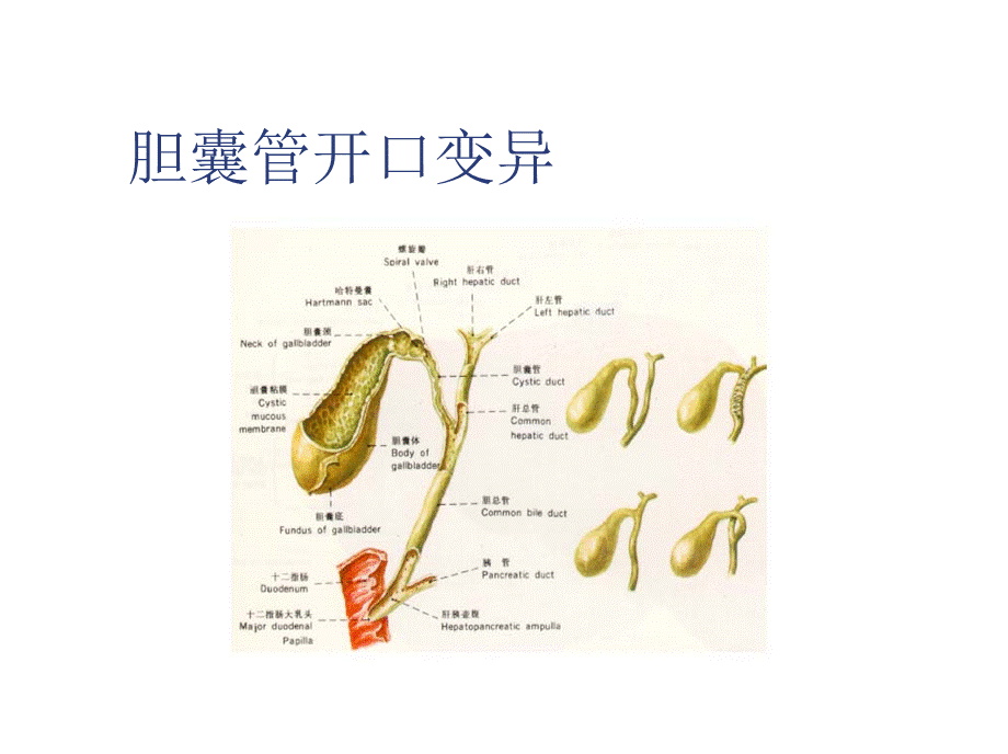 111外科-胆囊结石及其防治(1).ppt_第3页