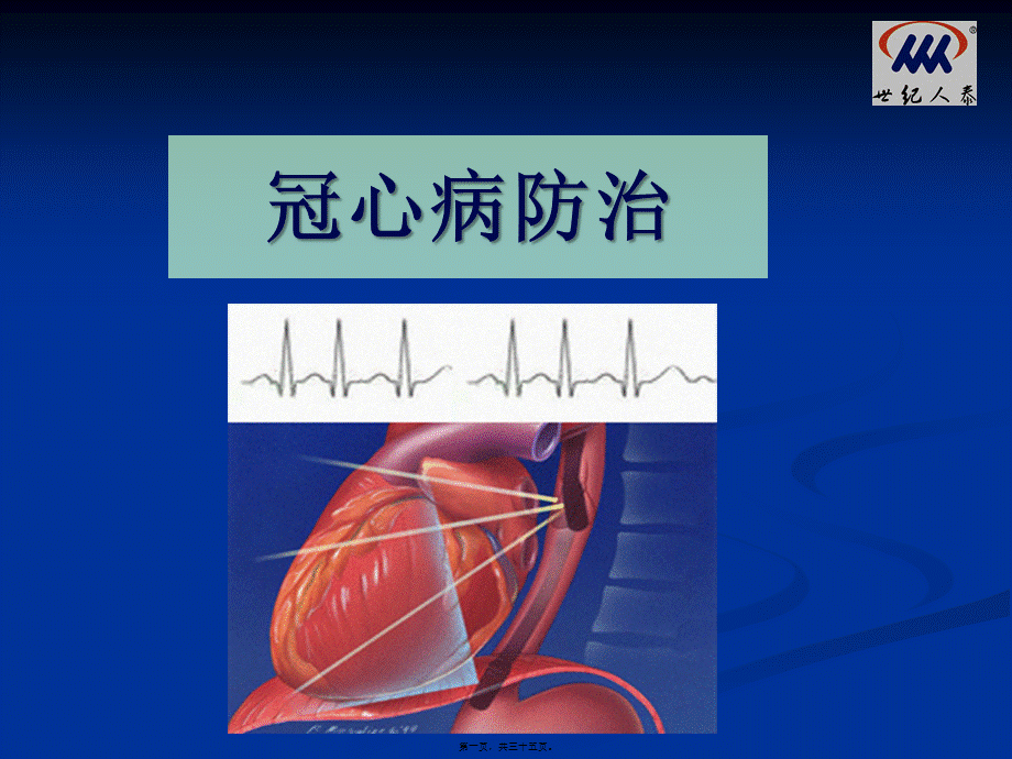 冠心病-2.pptx_第1页