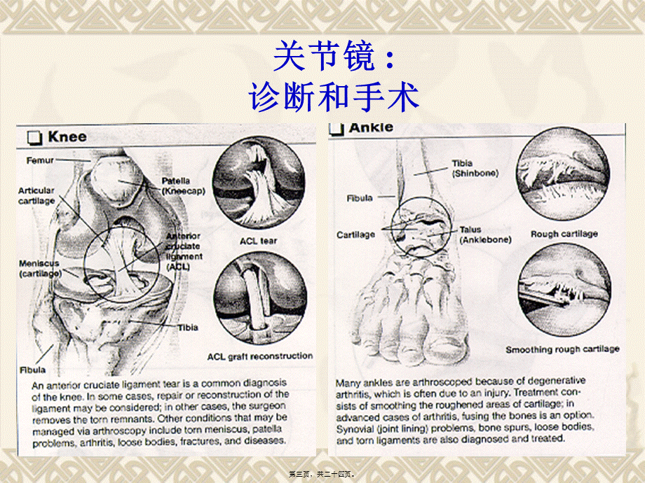 关节镜手术.pptx_第3页