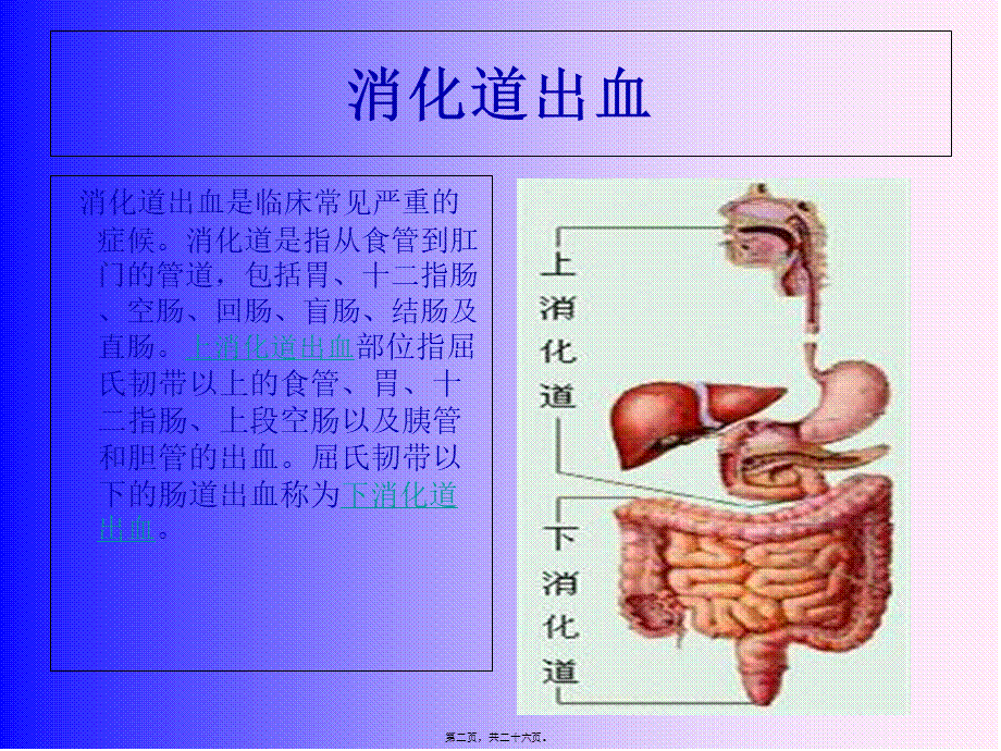 上消化道出血3.pptx_第2页