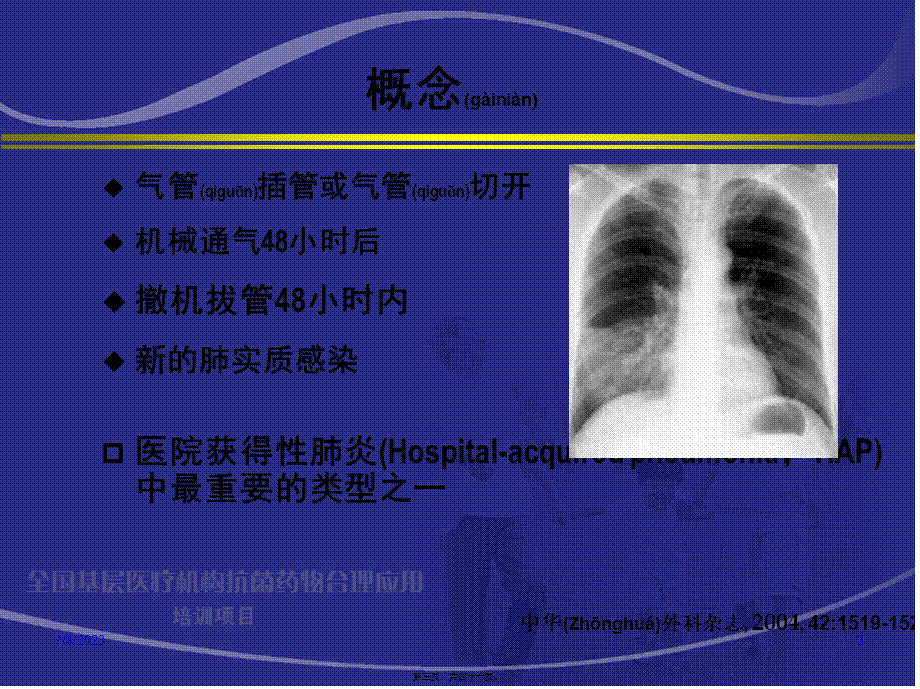 2022年医学专题—呼吸机相关性肺炎杨毅描述.ppt_第3页