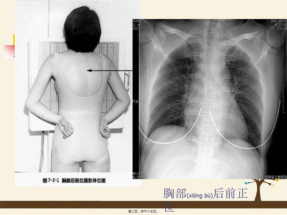 2022年医学专题—呼吸、循环、消化、泌尿影像学.ppt_第2页