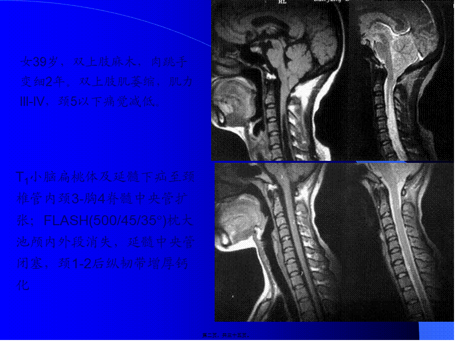 MRI图像-脑-01.pptx_第2页