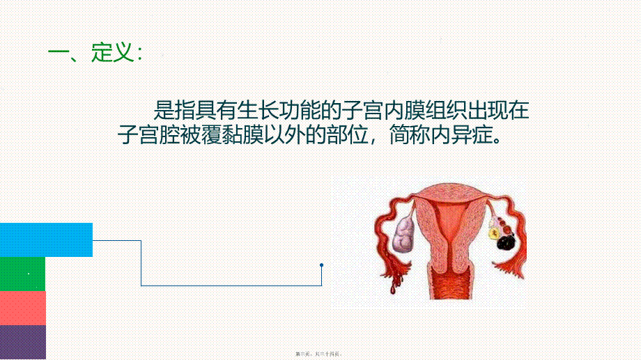 子宫内膜异位症.ppt_第3页