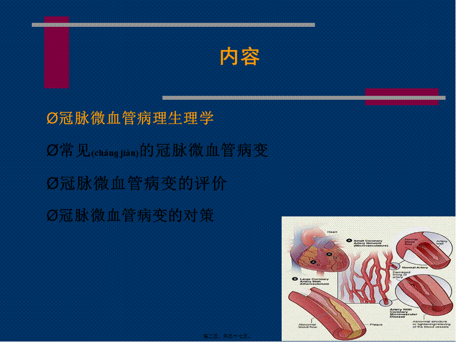 2022年医学专题—冠状动脉微血管病变及对策.ppt_第2页