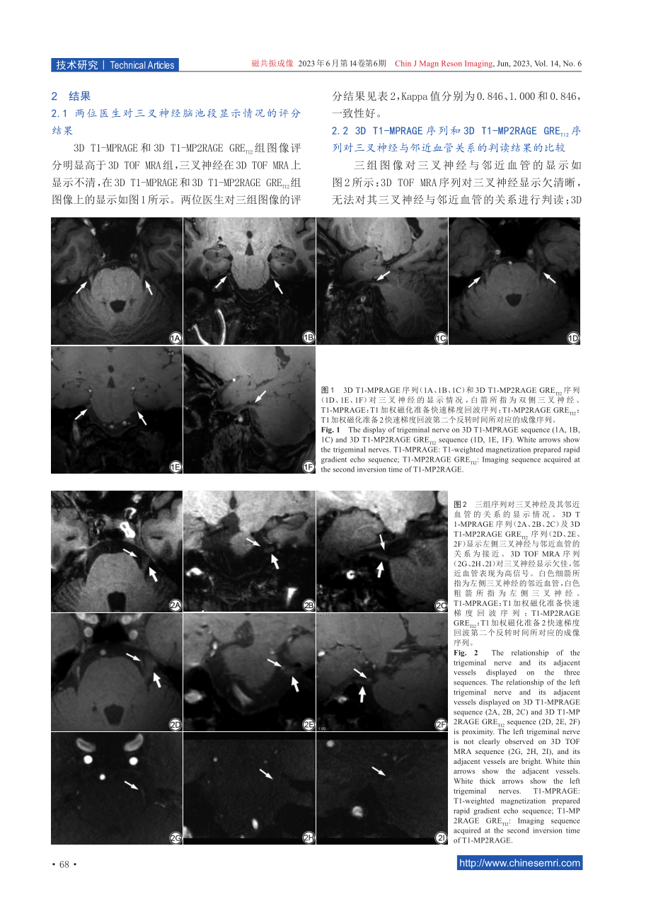 超高场7 T MRI对三叉神经及邻近血管的显示的应用研究.pdf_第3页