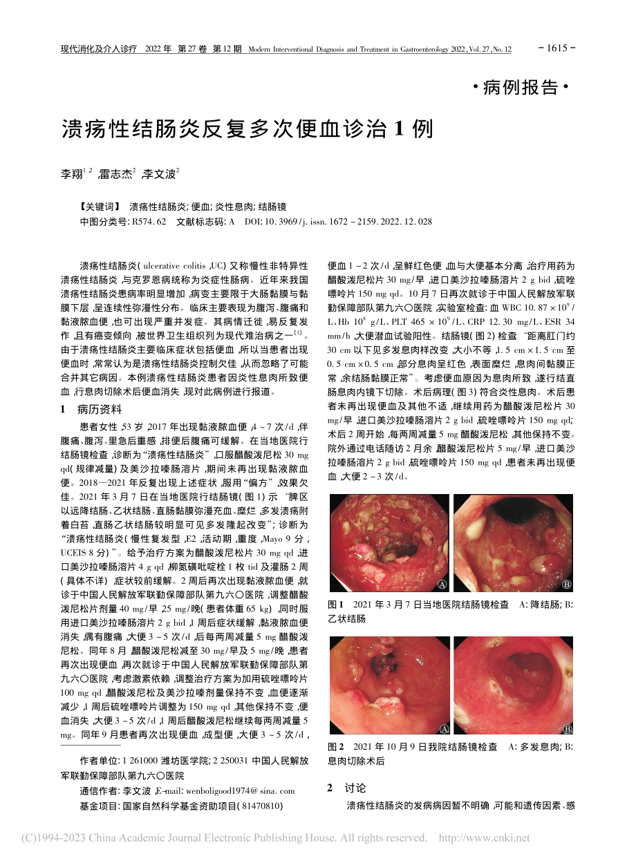 溃疡性结肠炎反复多次便血诊治1例_李翔.pdf_第1页