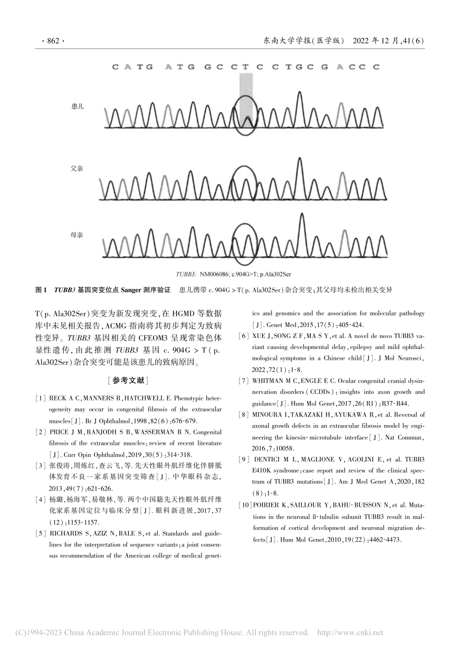 一例先天性眼外肌纤维化患儿TUBB3基因的变异分析_李晓东.pdf_第3页