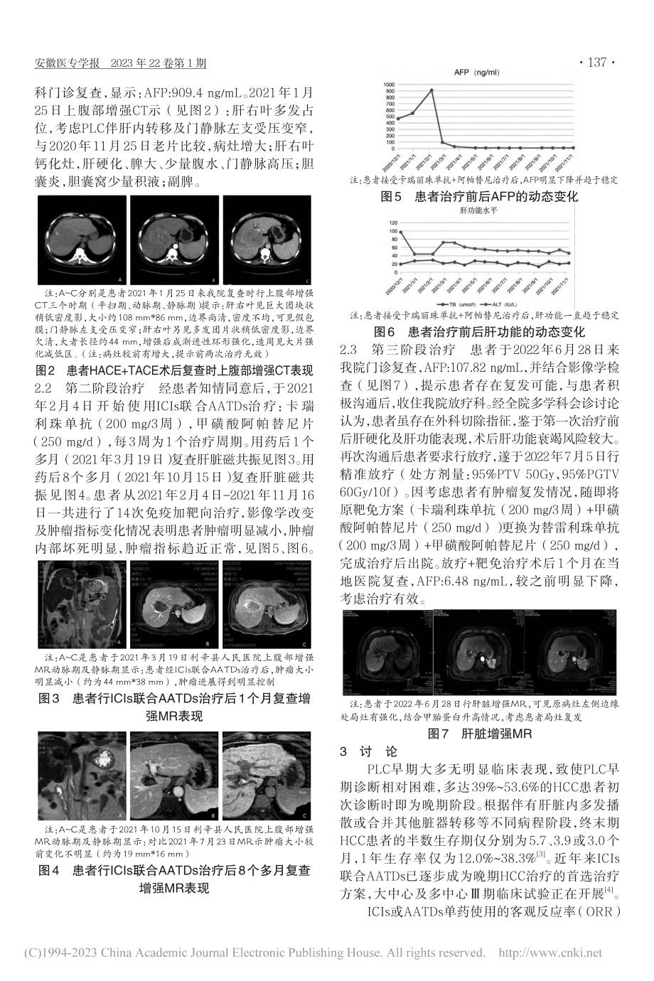 免疫联合靶向治疗巨块型肝细胞癌1例报道_谢治国.pdf_第2页