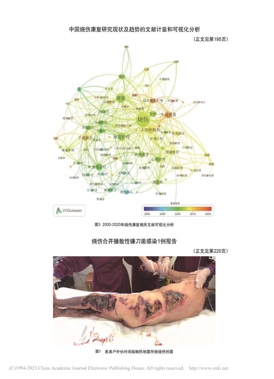 烧伤合并播散性镰刀菌感染1例报告_张友来.pdf_第3页