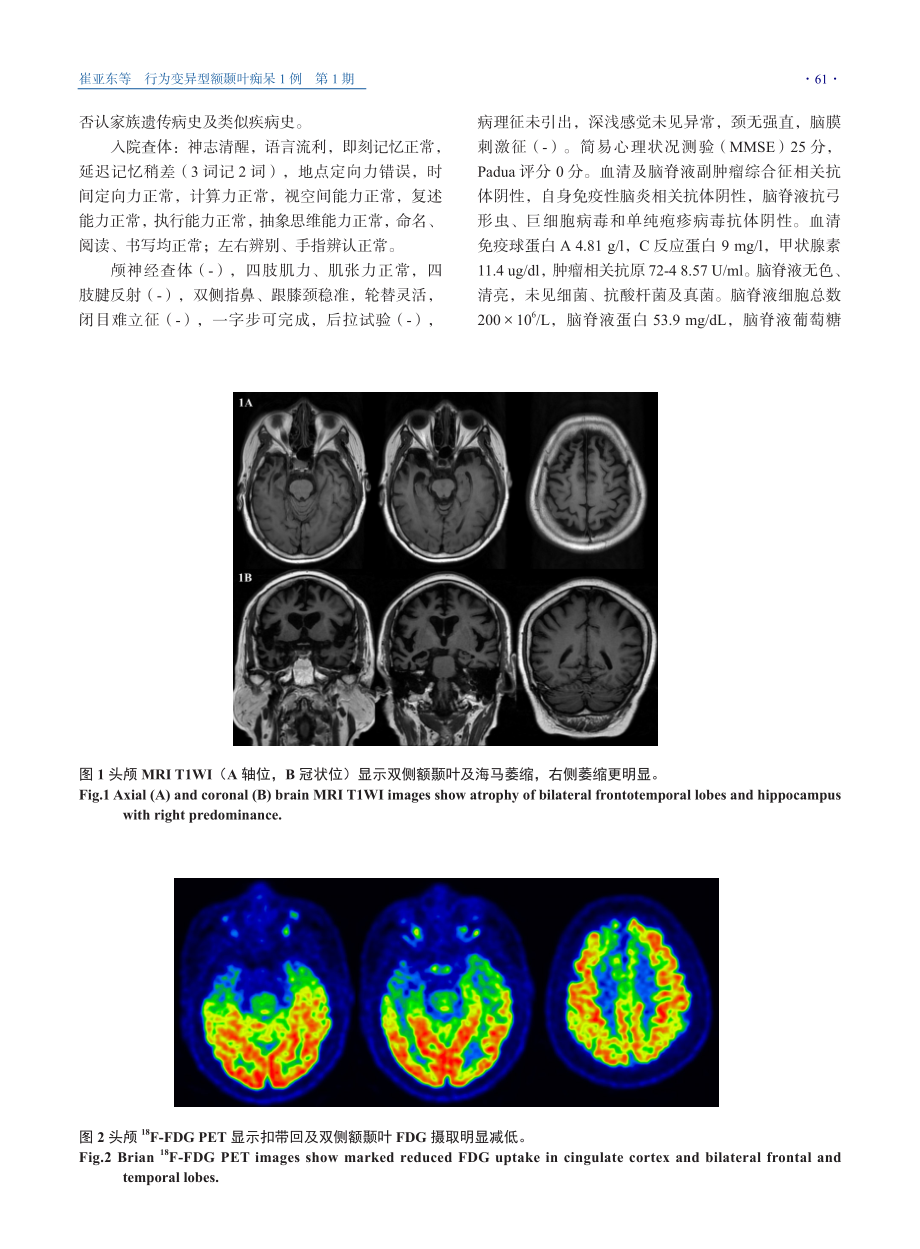 行为变异型额颞叶痴呆1例.pdf_第2页