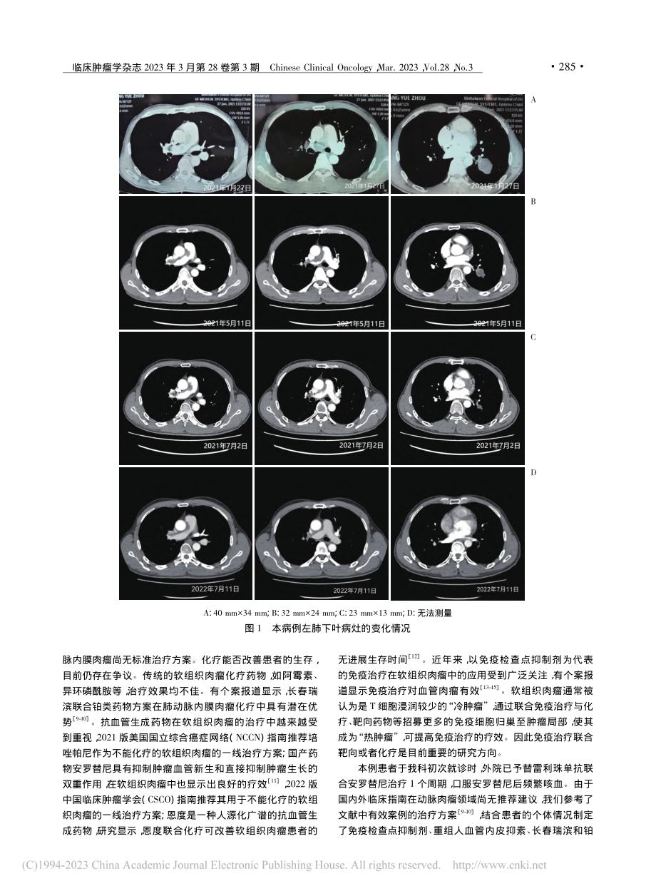 信迪利单抗联合化疗、重组人...抑素治疗肺动脉内膜肉瘤1例_张长征.pdf_第2页