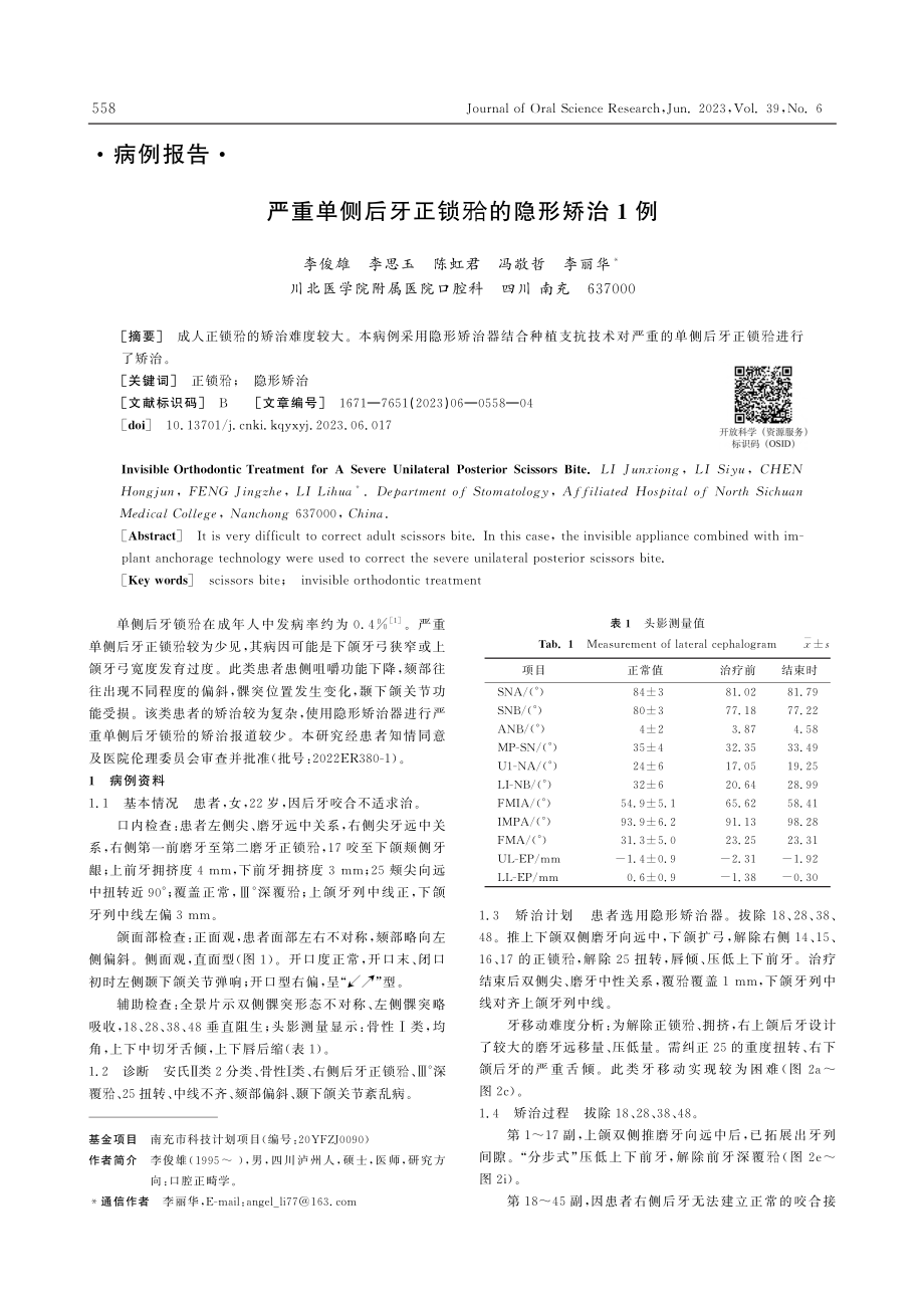 严重单侧后牙正锁(牙合)的隐形矫治1例_李俊雄.pdf_第1页