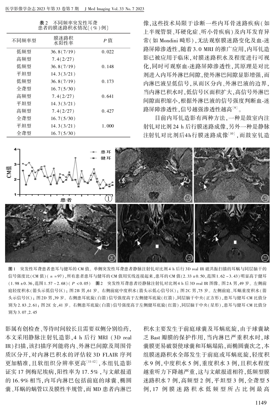 3.0MRI静脉内耳钆造影对单侧突发性耳聋患者的诊断价值.pdf_第3页