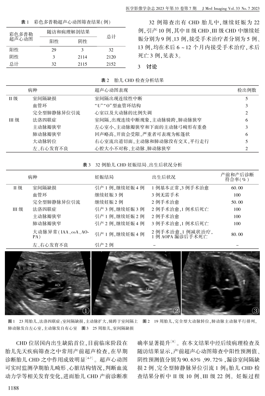 超声心动图联合产前咨询对胎儿先天性心脏病妊娠结局应用分析.pdf_第3页