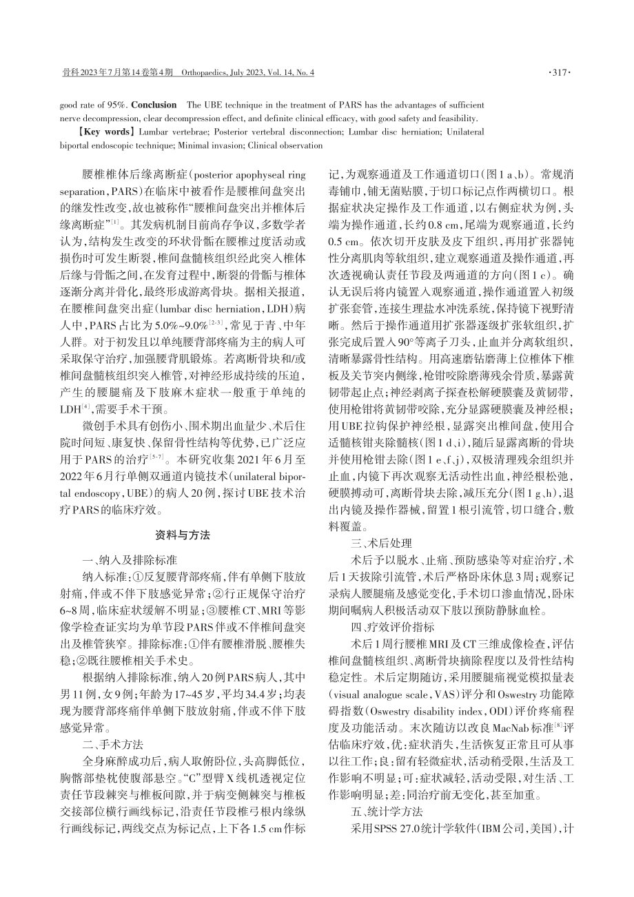 单侧双通道内镜技术治疗腰椎椎体后缘离断症的临床疗效.pdf_第2页