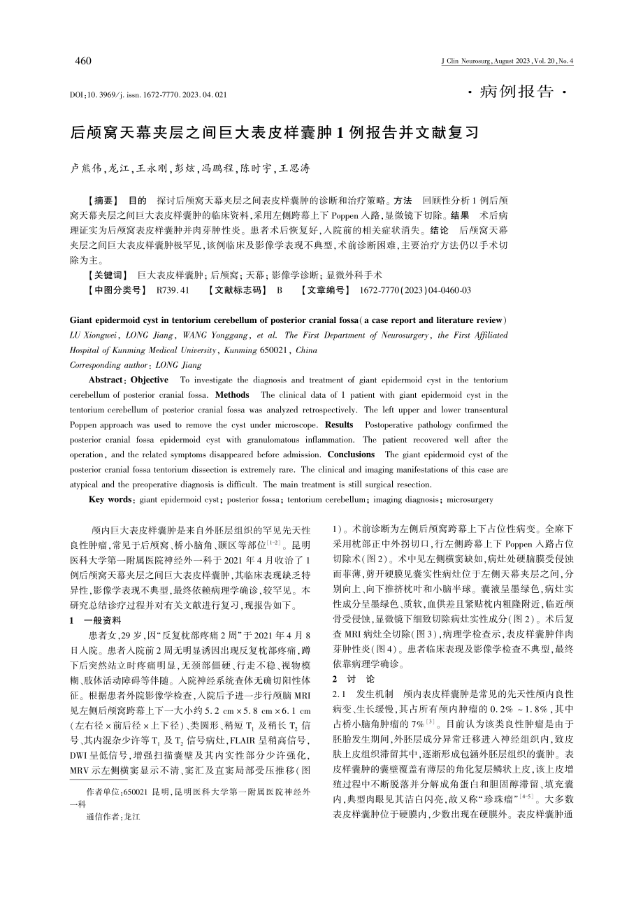 后颅窝天幕夹层之间巨大表皮样囊肿1例报告并文献复习.pdf_第1页