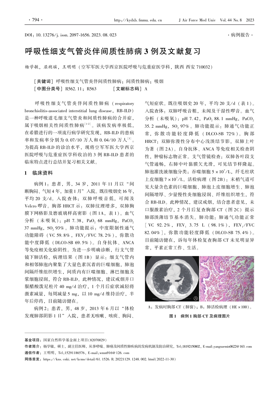 呼吸性细支气管炎伴间质性肺病3例及文献复习.pdf_第1页