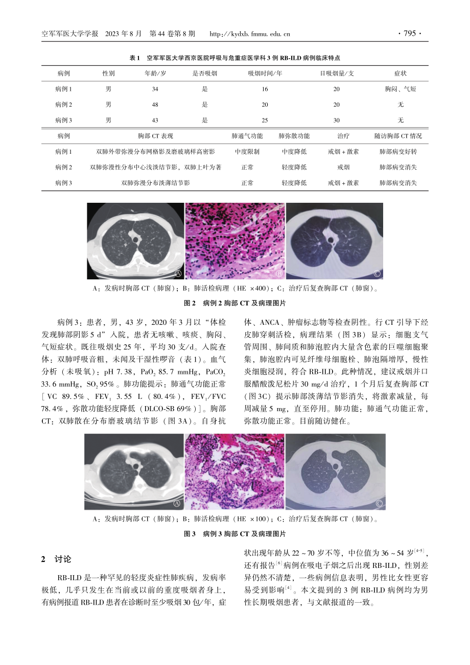 呼吸性细支气管炎伴间质性肺病3例及文献复习.pdf_第2页