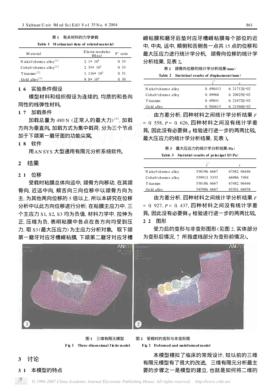 不同材料套筒冠的理论受载分析.pdf_第2页