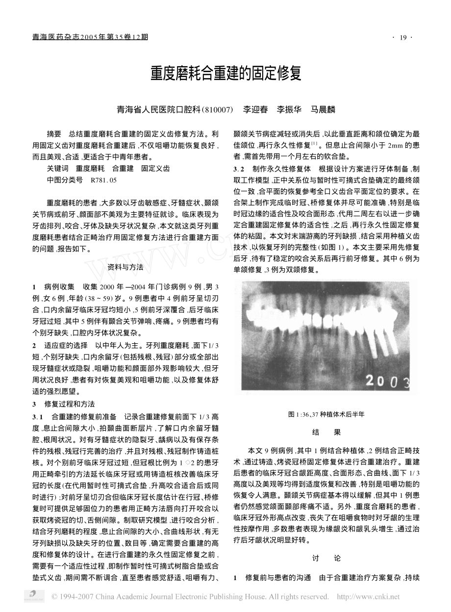 重度磨耗合重建的固定修复.pdf_第1页