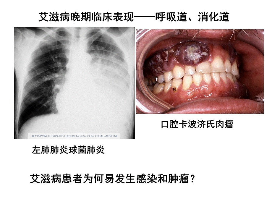 第五章 T细胞.ppt_第3页